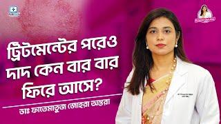 ট্রিটমেন্টের পরেও দাদ কেন ফিরে আসে? #fungalinfectiontreatment