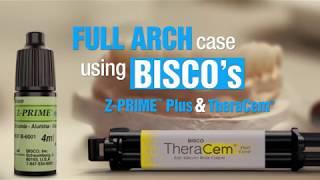 Full Arch Case using BISCO's Z-PRIME Plus and TheraCem