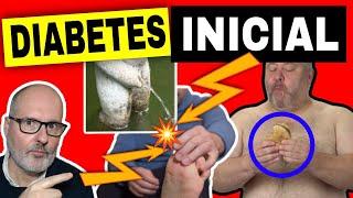 12 SÍNTOMAS INICIALES de DIABETES que NO DEBES IGNORAR