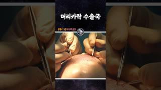 머리카락 수출국?