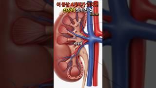 이 증상 4가지가 있다면 신장이 망가진 것