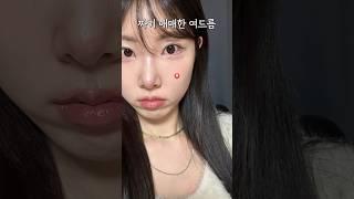 와.. 진쨔 쉬운 애매한 여드름 없애는 꿀팁 2가지 #여드름없애는방법 #여드름관리