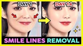  SMILE LINES (LAUGH LINES) REMOVAL AND FILL WITH KOREAN FACE EXERCISE & MASSAGE IN 2 WEEKS