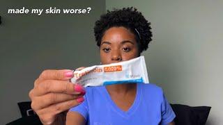 Why I Stopped using Tretinoin | NEW Skincare Routine