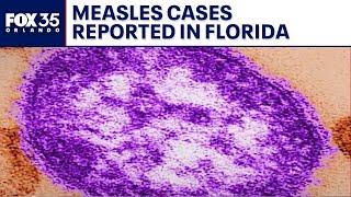 Measles case reported in Miami-Dade, Florida