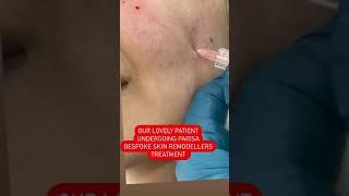 PARISA Bespoke Skin Remodellers Treatment | Dr Ashima Goel