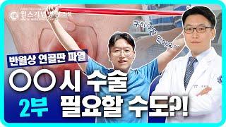 무릎 수술 막는 운동! 반월상 연골판 파열 예방 이렇게 하세요! ㅣ 안양윌스기념병원 김민규원장