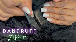 ASMR Dandruff ️| Dry and Flaky scalp relief | scratching, combing, oiling NO TALKING for sleep