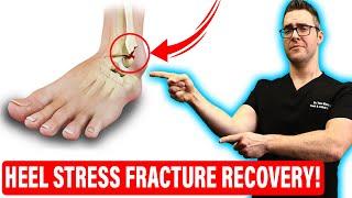 Calcaneus Stress Fracture Treatment [Heel Stress Fracture RECOVERY!]