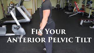 The BEST Way To FIX An Anterior Pelvic Tilt | W/ Lumbar Hyperlordosis