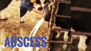 BEST ABSCESS COMPILATION