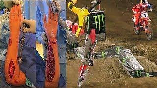 Big Supercross Crashes 2018 || Which is the worst?