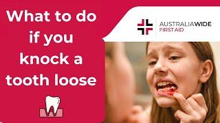 What To Do if You Knock a Tooth Loose