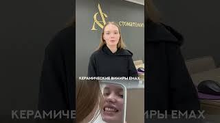 Керамические виниры EMAX #ОтзывАС #стоматология #пермь