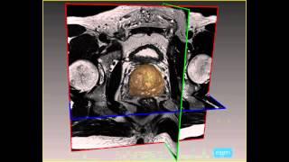 innoMedicus - ARTEMIS ProFuse Radiology Suite