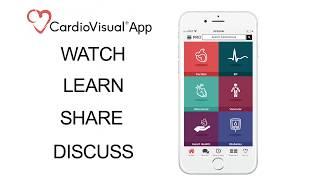 Introducing CardioVisual: Heart Health App built by Cardiologists