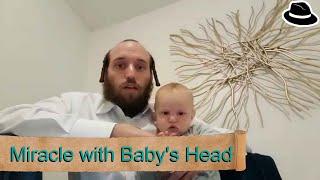 Miracle with Baby's Head