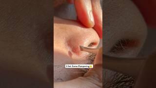 Oddly Satisfying Nose Hair Plucking – Watch Closely! PureMassage