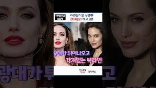 어려보이고 싶으면 관자필러!!  #동안얼굴만들기  #동안비법 #젊어지는법@김태영의피부공식