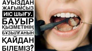 Ауыздан жағымсыз иіс шығу. Бауыр қызметінің бұзылғанын қайдан білеміз?