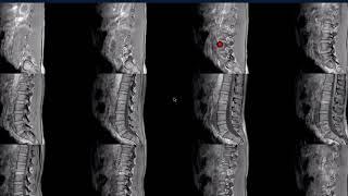 MR Safety Week 2018 #1: Low SAR Protocols