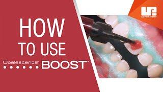 How to Use Opalescence™ Boost™ Professional Teeth Whitening | Step-by-Step Procedure