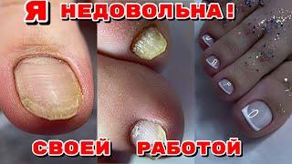 NOT SATISFIED WITH MY WORK  French Pedicure  We clean the subungual callus