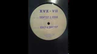 Edge vs Dentist - XVX Records