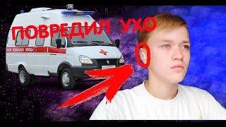 Повредил ухо!!!! Лопнула барабанная перепонка. //MATVEI VLOGS//