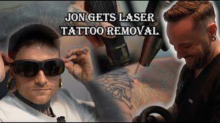 Jon Nelson Gets Laser Tattoo Removal