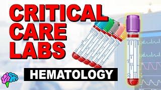 Hematology - Complete Blood Count (CBC) - Critical Care Labs