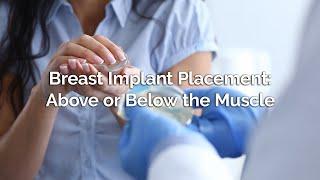 Breast Implant Placement - Above or Below the Muscle