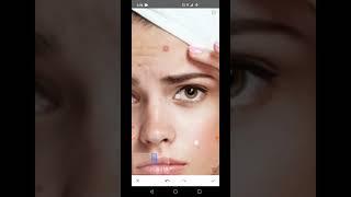 Remove Pimples From Face Trick!! By Snapseed || urban editz #shorts