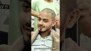 Crazy Full Hair Removal Bald Look in Summer