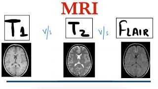 T1 MRI vs T2 MRI vs FLAIR MRI || MRI Brain || Radiology