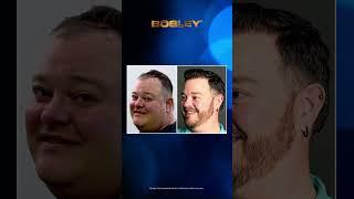Matt Z. | FUE | “The confidence level alone is everything.” #hairloss #fuehairtransplant #results
