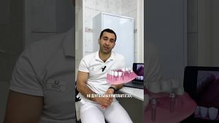 Как ухаживать за зубными имплантами🪥 #стоматология #зубныепротезы #зубныеимпланты
