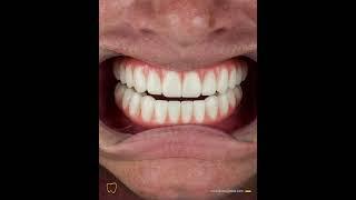 A brand new smile, a brand new beginning!Huge thanks to our amazing patient David Robert Mockridge