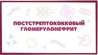 Постстрептококковый гломерулонефрит - причины, симптомы, осложнения (лекция) Osmosis