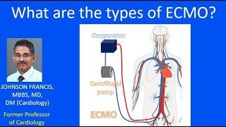 What are the types of ECMO?