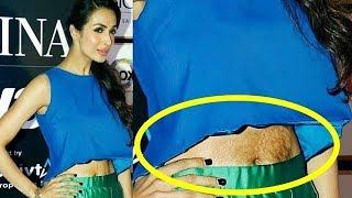 Malaika Arora FLAUNTS Stretch Mark In Public