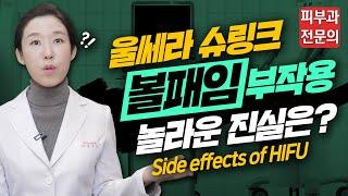 (*ENG/CHN/JP)  울쎄라 슈링크 더블로 리프팅 부작용 "볼패임", 받아도 될까? Side effects of HIFU - 피부과전문의 [닥터필러]