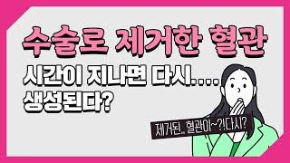 하지정맥류 수술 이후 제거된 혈관이 시간이 지나면 다시 생성되는게 맞는 이야기 일까?