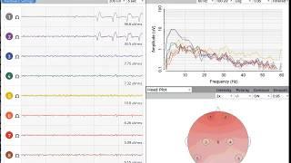 Eye Blinks Demo in the OpenBCI GUI