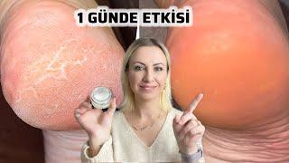 TOPUK ÇATLAKLARINA Anında Etki Eden Nem Bombası Krem Yapılışı! @EmineDeligoz