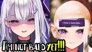 Ember is a Baldtuber