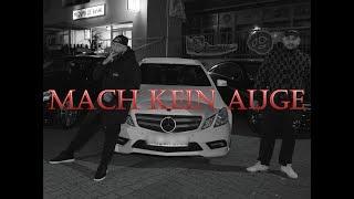 PUSHA & KOLOSS ,,Mach Kein Auge'' [Official Video] Prod. by Thundaa