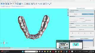 BlueSkyPlan Ortho: How To Read Report