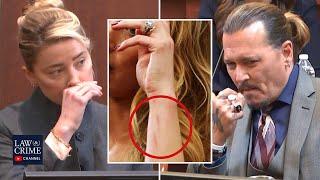 Photos of Amber Heard's Scars After Alleged Attack From Johnny Depp Presented in Court