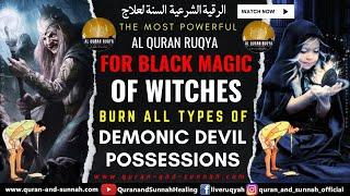 Quran Ruqyah To Destroy The Curse And Black Magic Of Witches And Burn The Demonic Jinn Possessions.